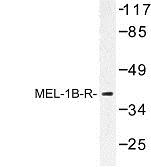 Western Blot: Melatonin Receptor 1B Antibody [NBP1-00922] - Western blot (WB) analysis of Melatonin Receptor 1B (V39) antibody in extracts from 293/Jurkat/HepG2 cells.