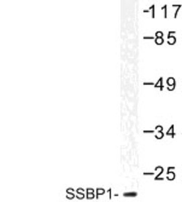 Western Blot: SSBP1 Antibody [NBP1-01021] - Western blot (WB) analysis of SSBP1 (Q100) antibody in extracts from HUVEC
