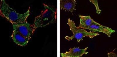 Immunocytochemistry/Immunofluorescence: KLHL13 Antibody (8D1) [NBP1-51623] - Immunofluorescence analysis of NTERA-2 cells (left) and U251 (right) cells using KLHL13 mouse mAb (green). Blue: DRAQ5 fluorescent DNA dye. Red: Actin filaments have been labeled with Alexa Fluor-555 phalloidin.