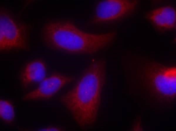 Immunocytochemistry/Immunofluorescence: S6K Antibody [NB100-82114] - Staining of methanol-fixed Hela cells using p70 S6 Kinase (Ab-424) ntibody