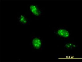 Immunocytochemistry/Immunofluorescence: TRMT1L Antibody [H00081627-B01] - C1orf25 ( Cat# H00081627-B01 ) on HeLa cell . [antibody concentration 10 ug/ml]
