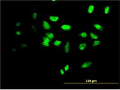 Immunocytochemistry/Immunofluorescence: FoxF2 Antibody (3F5) [H00002295-M03] - Immunofluorescence of monoclonal antibody to FOXF2 (H00002295-M03) on HeLa cell . [antibody concentration 30 ug/ml]