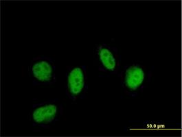 Immunocytochemistry/Immunofluorescence: LITAF Antibody [H00009516-B01P] - Immunofluorescence of purified MaxPab antibody to LITAF on HeLa cell. [antibody concentration 10 ug/ml]