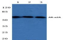 Western Blot: Alpha 2a Adrenergic Receptor Antibody [NBP1-19562] - Lane1:Hela whole cell lysate. Lane2:Mouse kidney tissue lysate. Lane3:H9C2 whole cell lysate.