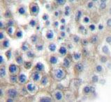 Immunohistochemistry: Alpha 2a Adrenergic Receptor Antibody [NBP1-19562] - Alpha 2a Adrenergic Receptor Antibody  paraffin-embedded human testis tissue.