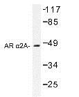 Western Blot: Alpha 2a Adrenergic Receptor Antibody [NBP1-19562] - Alpha 2a Adrenergic Receptor Antibody extracts from Jurkat cells.