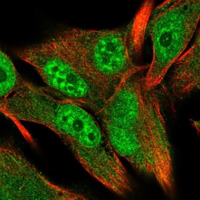 Immunocytochemistry/Immunofluorescence: YTHDF3 Antibody [NBP2-38588] - Immunofluorescent staining of human cell line SK-MEL-30 shows positivity in nuclear membrane, cytoplasm and nucleus but excluded from the nucleoli.