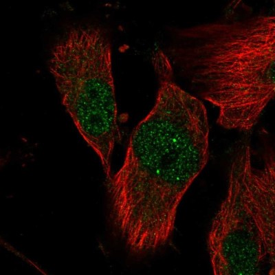 Immunocytochemistry/Immunofluorescence: TRMT2B Antibody [NBP2-38475] - Immunofluorescent staining of human cell line U-251 MG shows positivity in nucleus but excluded from the nucleoli.