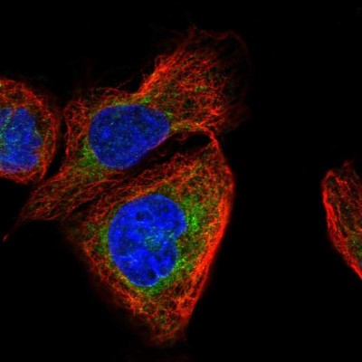 Immunocytochemistry/Immunofluorescence: RBJ Antibody [NBP2-38333] - Immunofluorescent staining of human cell line A-431 shows positivity in cytoplasm.