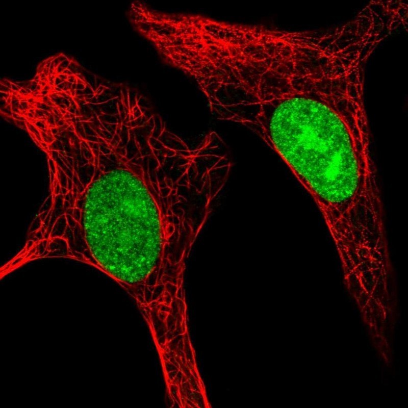 Immunocytochemistry/Immunofluorescence: DDX52 Antibody [NBP2-33776] - Immunofluorescent staining of human cell line A-549 shows positivity in nucleus & nucleoli.