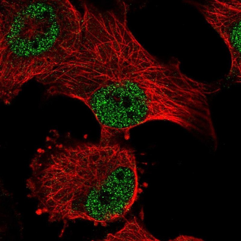 Immunocytochemistry/Immunofluorescence: HIVEP2 Antibody [NBP2-33771] - Immunofluorescent staining of human cell line U-251 MG shows positivity in nucleus but excluded from the nucleoli.