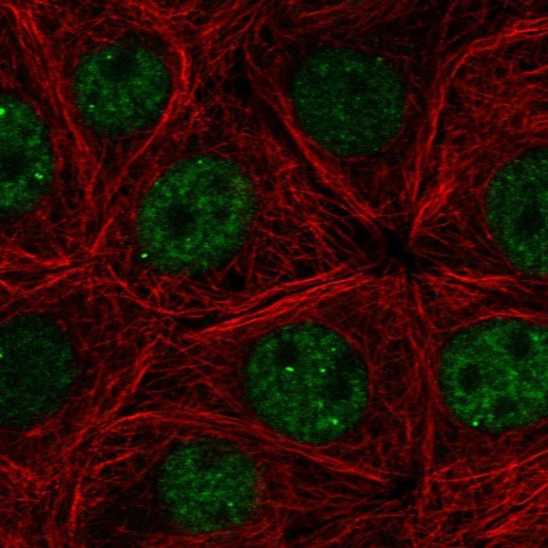 Immunocytochemistry/Immunofluorescence: FYTTD1 Antibody [NBP2-33715] - Immunofluorescent staining of human cell line MCF-7 shows positivity in nucleus but excluded from the nucleoli.