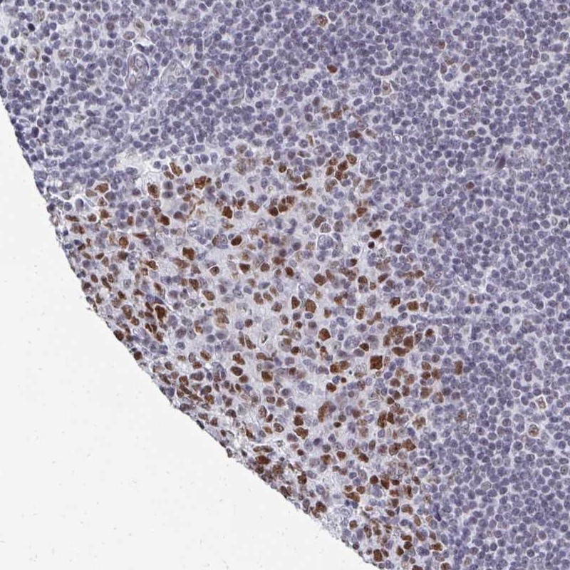 Immunohistochemistry: Suppressor of Ty 4 homolog 1 Antibody [NBP2-31794] - Immunohistochemical staining of human tonsil shows strong nuclear positivity in germinal center cells.