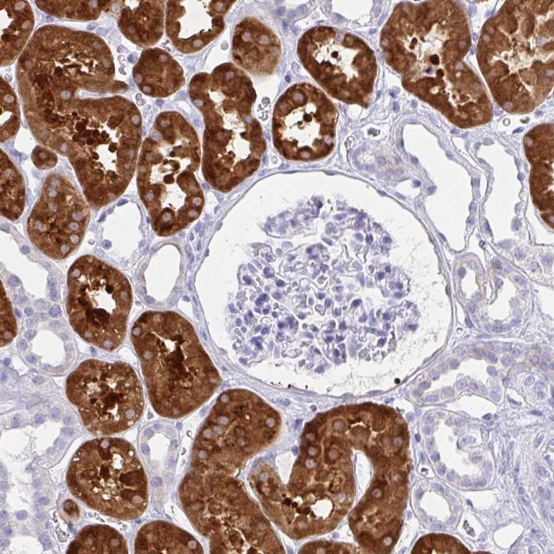 Immunohistochemistry: Glycine Receptor alpha 1 + alpha 2 Antibody [NBP2-31828] - Immunohistochemical staining of human kidney shows strong cytoplasmic positivity in renal tubules.
