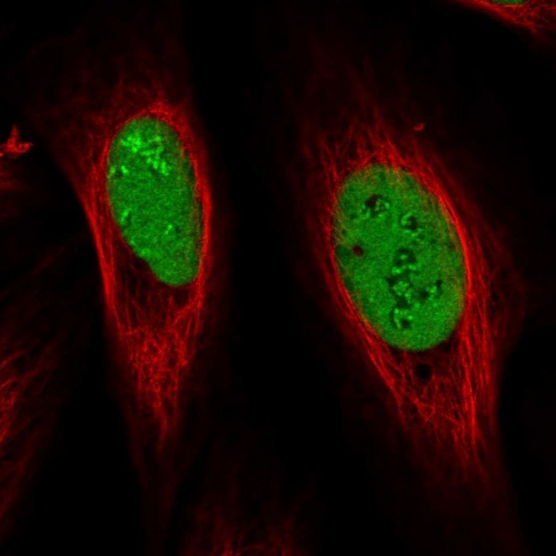 Immunocytochemistry/Immunofluorescence: NOLA1 Antibody [NBP2-31742] - Immunofluorescent staining of human cell line U-2 OS shows positivity in nucleus & nucleoli.