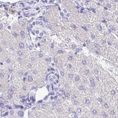 Immunohistochemistry: Glycine Receptor alpha 1 + alpha 2 Antibody [NBP2-31561] - liver