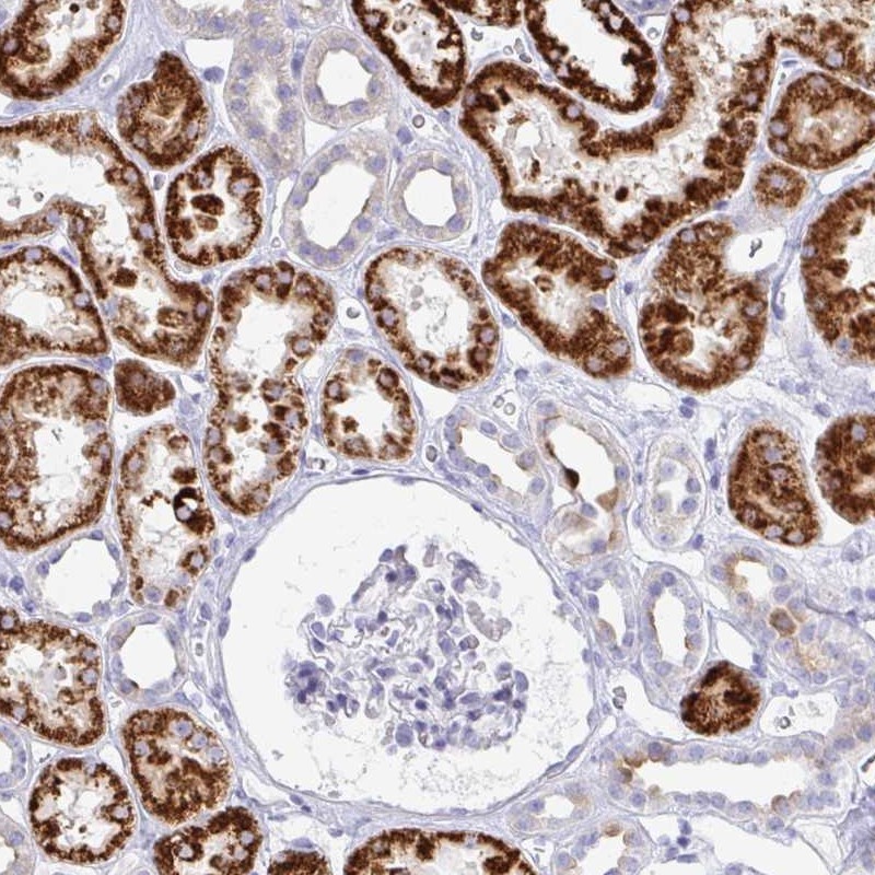 Immunohistochemistry: Glycine Receptor alpha 1 + alpha 2 Antibody [NBP2-31561] - Immunohistochemical staining of human kidney shows strong cytoplasmic positivity in a subset of renal tubules.