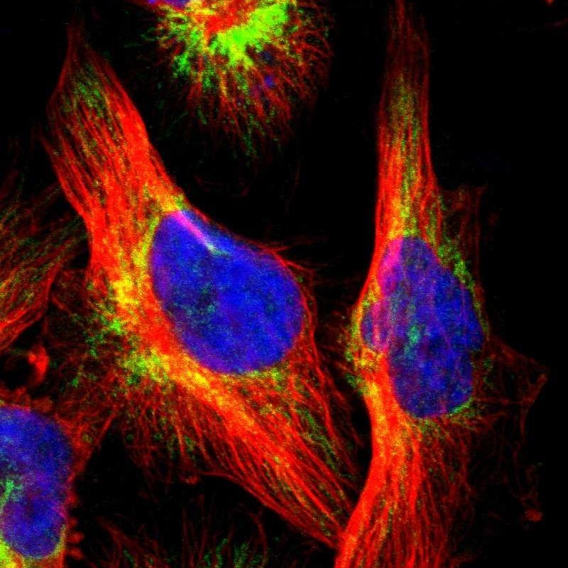 Immunocytochemistry/Immunofluorescence: UBE2H Antibody [NBP1-80650] - Immunofluorescent staining of human cell line U-251MG shows positivity in mitochondria.