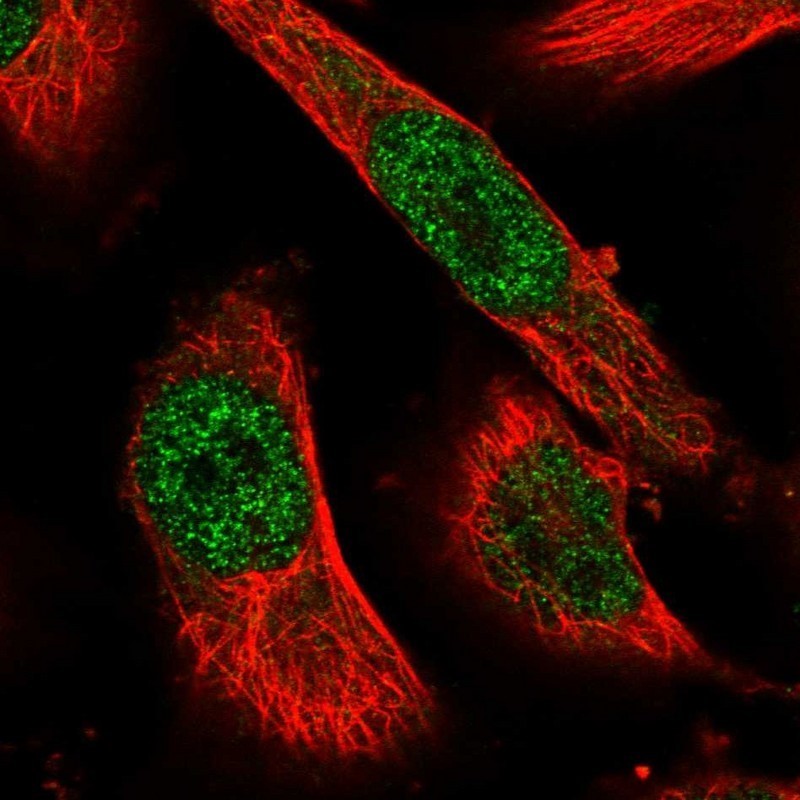 Immunocytochemistry/Immunofluorescence: ZNF546 Antibody [NBP1-81076] - Staining of human cell line U-251MG shows positivity in nucleus but not nucleoli.