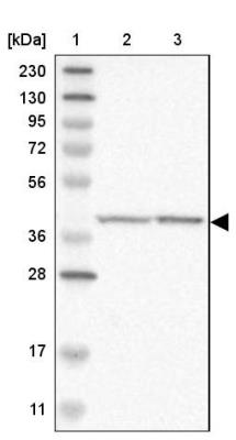 Western Blot: C9orf43 Antibody [NBP1-82743] - Lane 1: Marker [kDa] 230, 130, 95, 72, 56, 36, 28, 17, 11<br/>Lane 2: Human cell line RT-4<br/>Lane 3: Human cell line U-251MG sp