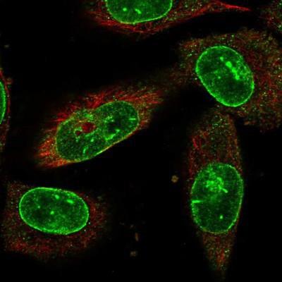 Immunocytochemistry/Immunofluorescence: NEK1 Antibody [NBP1-82883] - Staining of human cell line U-251 MG shows positivity in nuclear membrane.