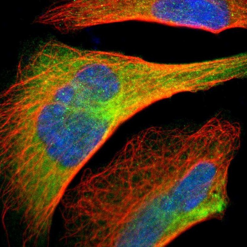 Immunocytochemistry/Immunofluorescence: KIF2C Antibody [NBP1-82870] - Staining of human cell line U-2 OS shows positivity in cytoplasm & cytoskeleton (intermediate filaments).