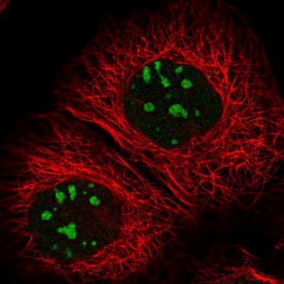 Immunocytochemistry/Immunofluorescence: RBM34 Antibody [NBP1-83039] - Staining of human cell line A-431 shows positivity in nucleus & nucleoli.