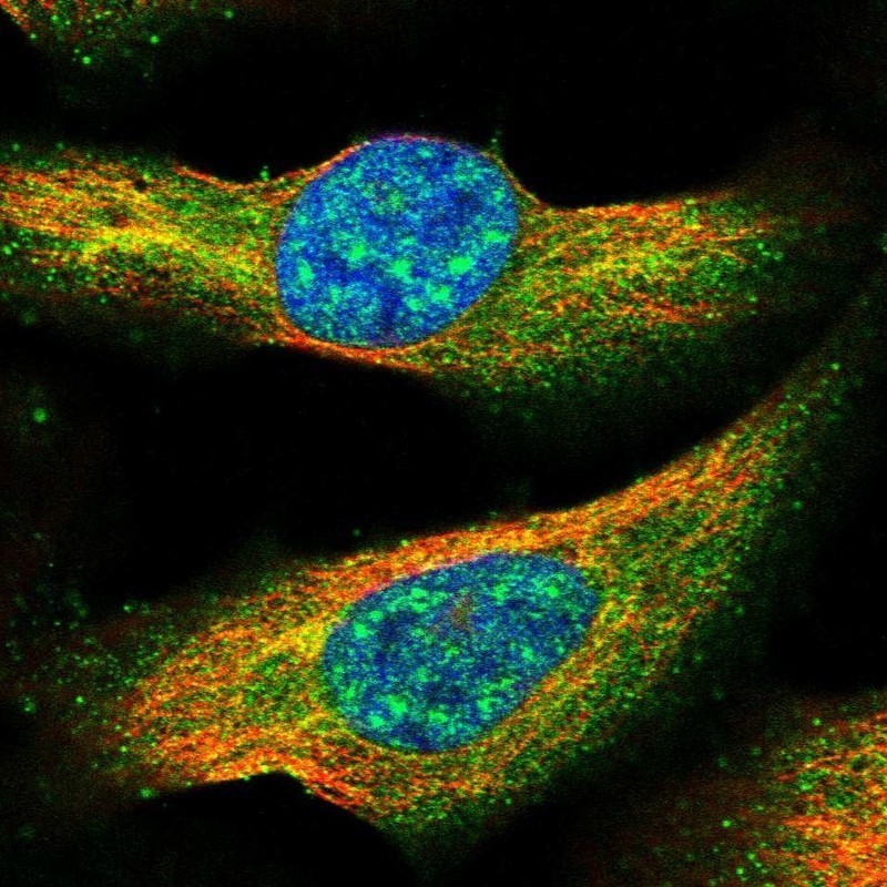 Immunocytochemistry/Immunofluorescence: NUDCD3 Antibody [NBP1-82940] - Staining of human cell line U-2 OS shows positivity in nucleus but not nucleoli & cytoplasm.