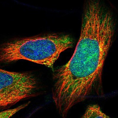 Immunocytochemistry/Immunofluorescence: CDCA7L Antibody [NBP1-83074] - Staining of human cell line U-2 OS shows positivity in nucleus, nucleoli & cytoplasm.