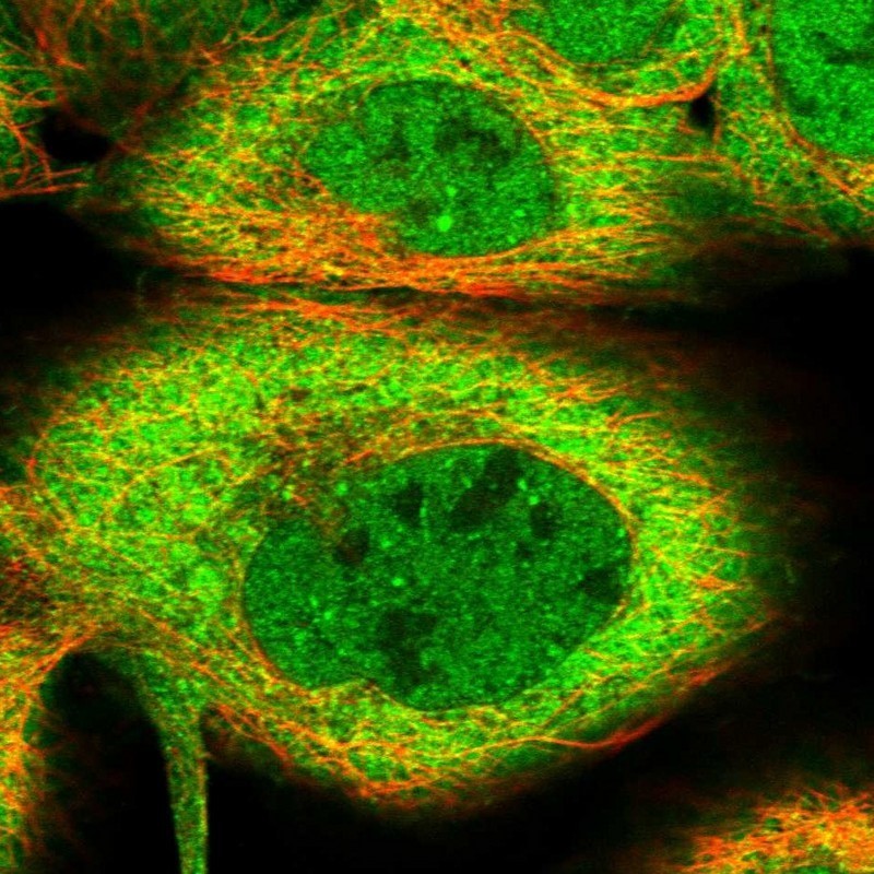 Immunocytochemistry/Immunofluorescence: eIF4H Antibody [NBP1-83057] - Immunofluorescent staining of human cell line A-431 shows positivity in nucleus but not nucleoli & cytoplasm.