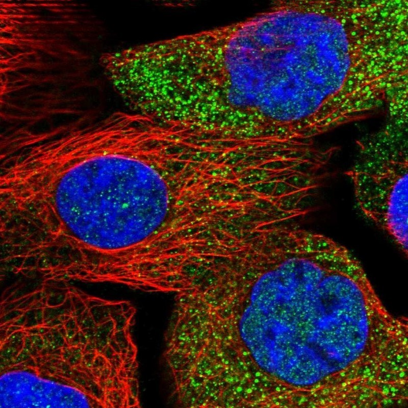 Immunocytochemistry/Immunofluorescence: JMJD5 Antibody [NBP1-82249] - Staining of human cell line A-431 shows positivity in nucleus but not nucleoli & cytoplasm.