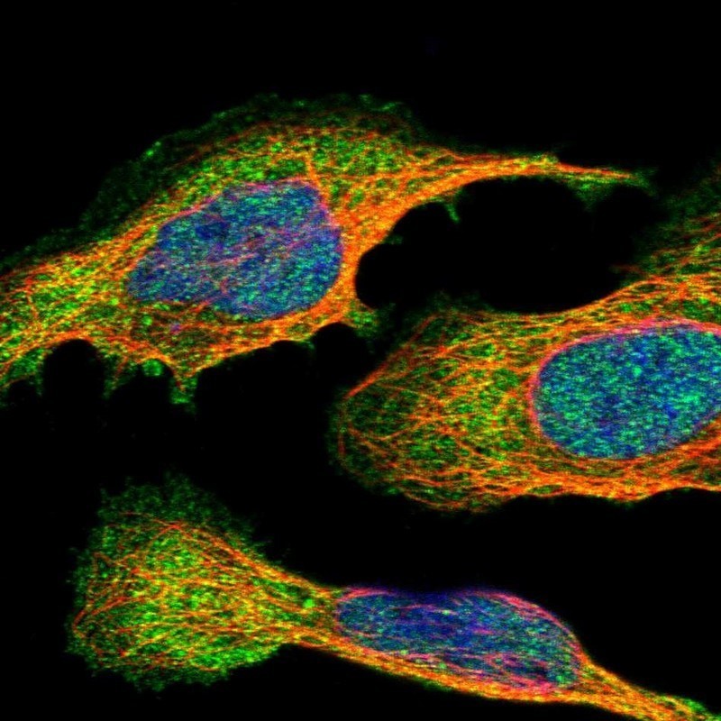 Immunocytochemistry/Immunofluorescence: TRIT1 Antibody [NBP1-82210] - Staining of human cell line U-2 OS shows positivity in nucleus but not nucleoli, plasma membrane & cytoplasm.