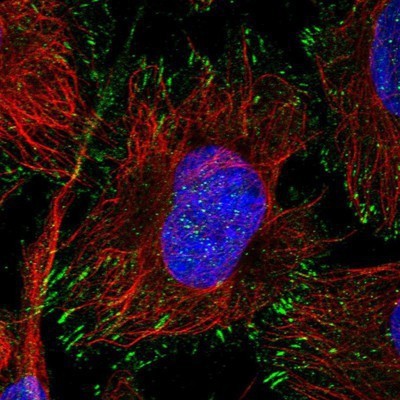 Immunocytochemistry/Immunofluorescence: BSPRY Antibody [NBP1-82204] - Staining of human cell line U-2 OS shows positivity in nucleus but not nucleoli, cytoplasm & focal adhesions.