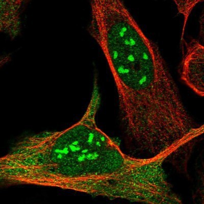 Immunocytochemistry/Immunofluorescence: Exosome component 10 Antibody [NBP1-82447] - Staining of human cell line U-2 OS shows positivity in nucleus, nucleoli & cytoplasm.