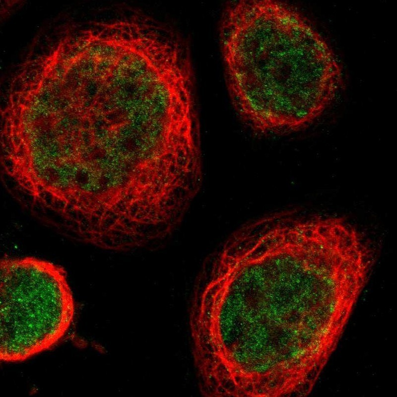 Immunocytochemistry/Immunofluorescence: B3GALNT2 Antibody [NBP1-82699] - Staining of human cell line A-431 shows positivity in nucleus but not nucleoli & golgi apparatus.