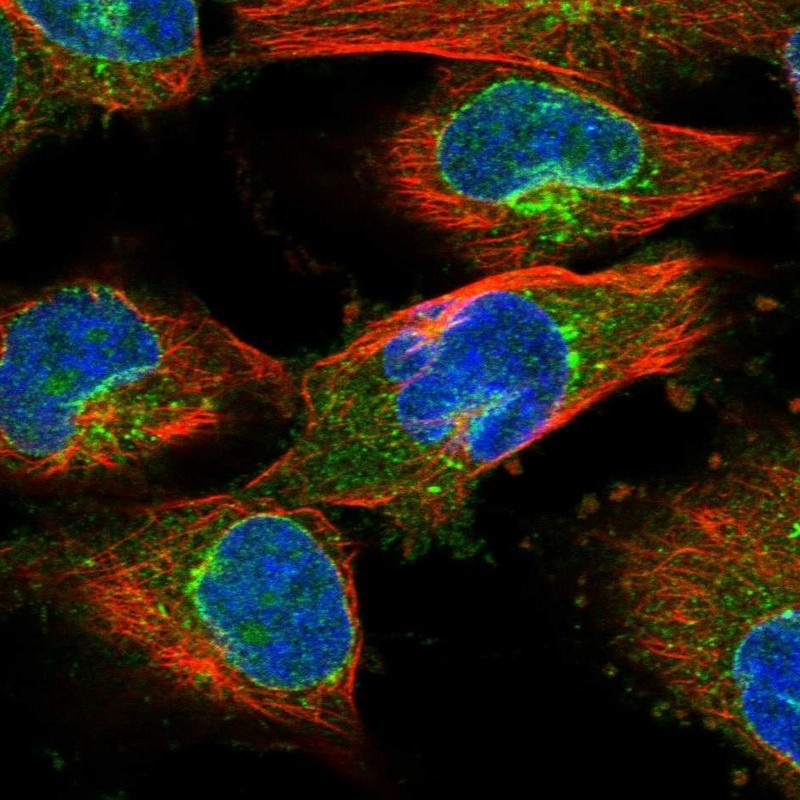 Immunocytochemistry/Immunofluorescence: PROCA1 Antibody [NBP1-82697] - Staining of human cell line U-251MG shows positivity in nuclear membrane & vesicles.
