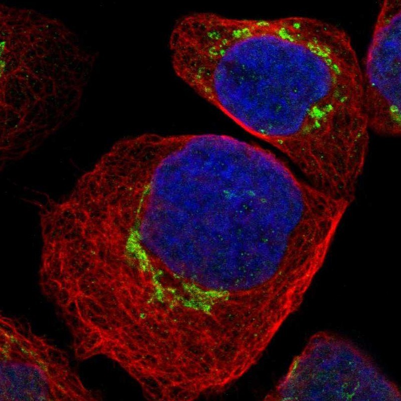 Immunocytochemistry/Immunofluorescence: C19orf18 Antibody [NBP1-82690] - Staining of human cell line A-431 shows positivity in golgi.
