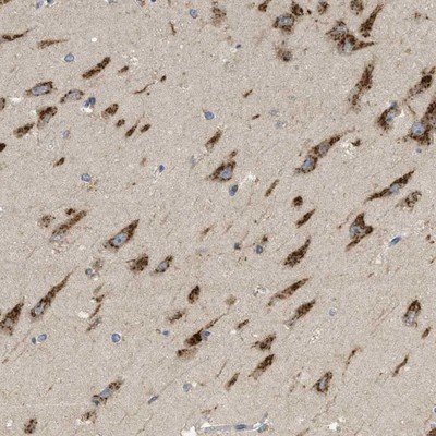 Immunohistochemistry-Paraffin: C19orf18 Antibody [NBP1-82690] - Staining of human hippocampus shows cytoplasmic positivity with a granular pattern in neuronal cells.