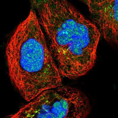 Immunocytochemistry/Immunofluorescence: PARP10 Antibody [NBP1-83689] - Staining of human cell line A-431 shows positivity in nucleus but not nucleoli & golgi apparatus.