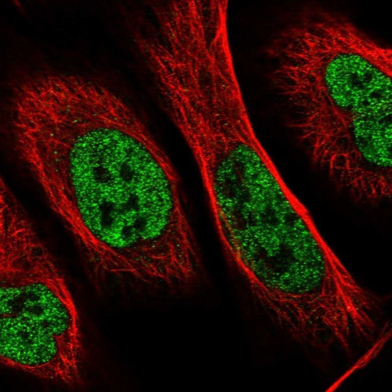 Immunocytochemistry/Immunofluorescence: NUDT15 Antibody [NBP1-83800] - Staining of human cell line U-2 OS shows positivity in nucleus but not nucleoli.