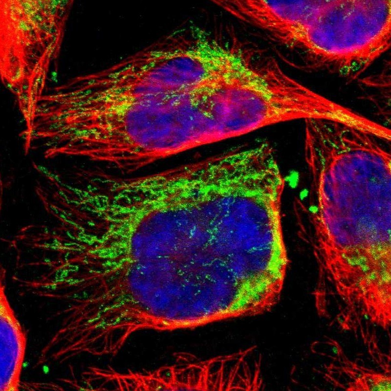 Immunocytochemistry/Immunofluorescence: VAMP8 Antibody [NBP1-84013] - Staining of human cell line U-2 OS shows positivity in mitochondria.