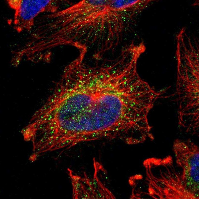 Immunocytochemistry/Immunofluorescence: SRPX Antibody [NBP1-83948] - Staining of human cell line U-251MG shows positivity in vesicles.