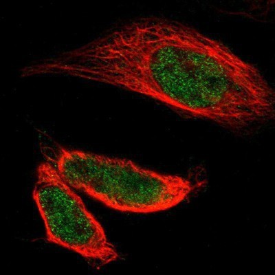 Immunocytochemistry/Immunofluorescence: ZMAT1 Antibody [NBP1-81375] - Staining of human cell line A-431 shows positivity in nuclei but not nucleoli.