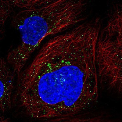 Immunocytochemistry/Immunofluorescence: SEC24C Antibody [NBP1-81549] - Staining of human cell line A-431 shows positivity in vesicles.