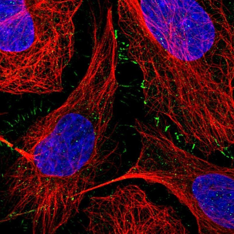 Immunocytochemistry/Immunofluorescence: UHRF1BP1L Antibody [NBP1-81486] - Staining of human cell line U-2 OS shows positivity in plasma membrane.