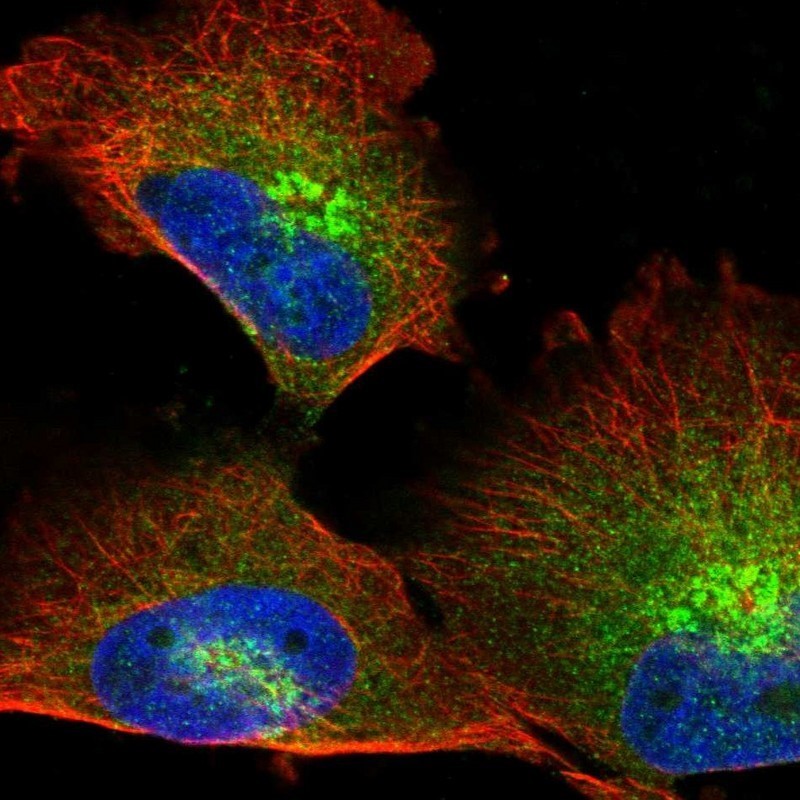 Immunocytochemistry/Immunofluorescence: MICAL2 Antibody [NBP1-81483] - Staining of human cell line U-251MG shows positivity in golgi apparatus.