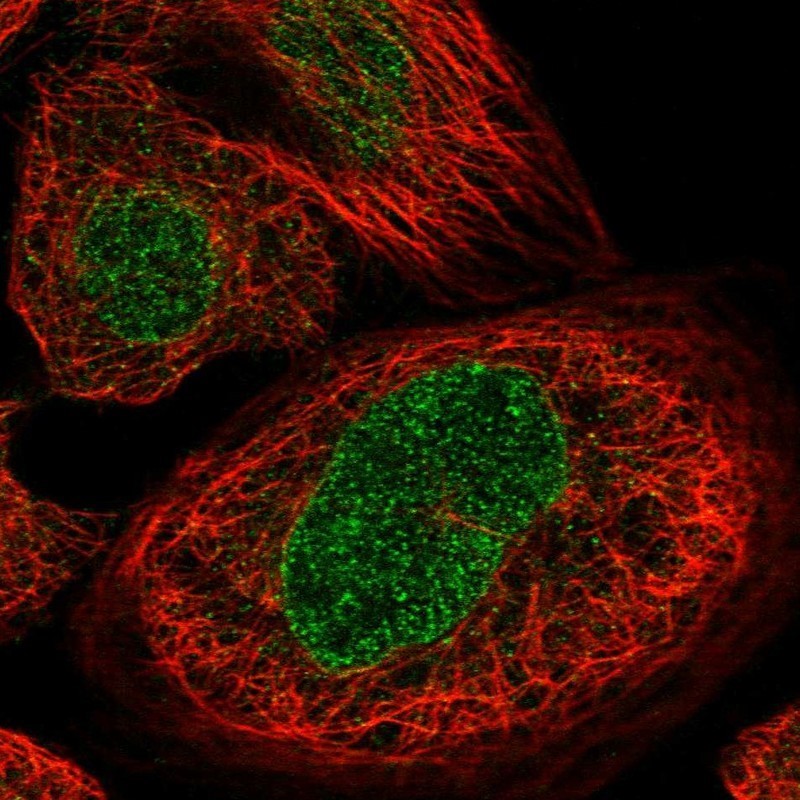 Immunocytochemistry/Immunofluorescence: ZNF124 Antibody [NBP1-81634] - Staining of human cell line A-431 shows positivity in nucleus.
