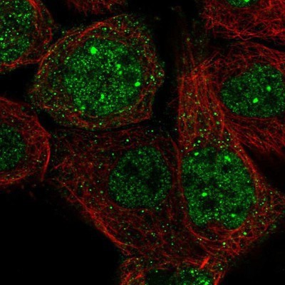 Immunocytochemistry/Immunofluorescence: HOXA2 Antibody [NBP1-81721] - Staining of human cell line A-431 shows positivity in nucleus but not nucleoli.