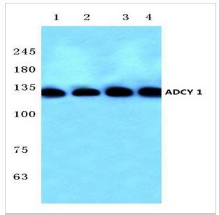 Western Blot: Adenylate Cyclase 1 Antibody [NBP1-19628] - Lane1:Hela whole cell lysate. Lane2:HEK293T whole cell lysate. Lane3:Mouse liver tissue lysate. Lane4:Rat kidney tissue lysate.