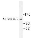 Western Blot: Adenylate Cyclase 1 Antibody [NBP1-19628] - extracts from COLO205 cells.